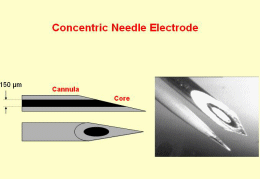 invasive needle electrodes