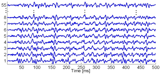 Generated synthetic signals with 20 active MUs. For clarity reasons, only a portion of generated SEMG signals is depicted.