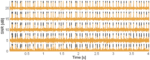 Original synthetic innervation pulse trains (black) and the pulse trains reconstructed by the method based on TF distributions (brown) in the case of 5 active MUs and at SNR = 20, 15, 10, 5 and 0 dB.