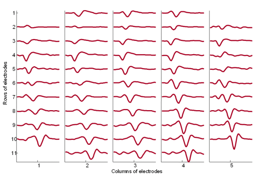 The MUAPs corresponding to MU 2 (Fig. 14) reconstructed by the spike triggered sliding window averaging technique (210 averages) from 30 s long SEMG signals. The MUAPs are depicted with respect to the relative position of the corresponding pick-up electrodes. Surface EMG signals were recorded during an isometric 5 % MVC measurement of the dominant biceps brachii of  healthy male subject (age 26 years, height 176 cm, weight 68 kg).