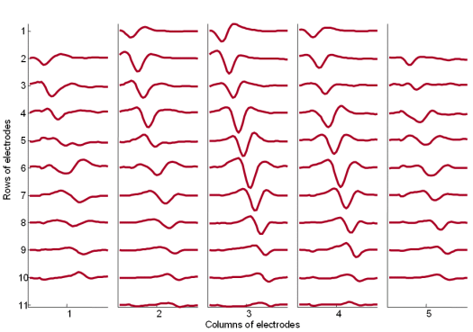 The MUAPs corresponding to MU 1 reconstructed by the spike triggered sliding window averaging technique (293 averages) from 30 s long SEMG signals. The MUAPs are depicted with respect to the relative position of the corresponding spatial filter. Surface EMG signals were recorded during an isometric 10 % MVC measurement of the dominant biceps brachii of  healthy male subject (age 31 years, height 180 cm, weight 65 kg).