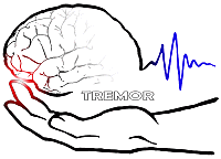 TREMOR logo